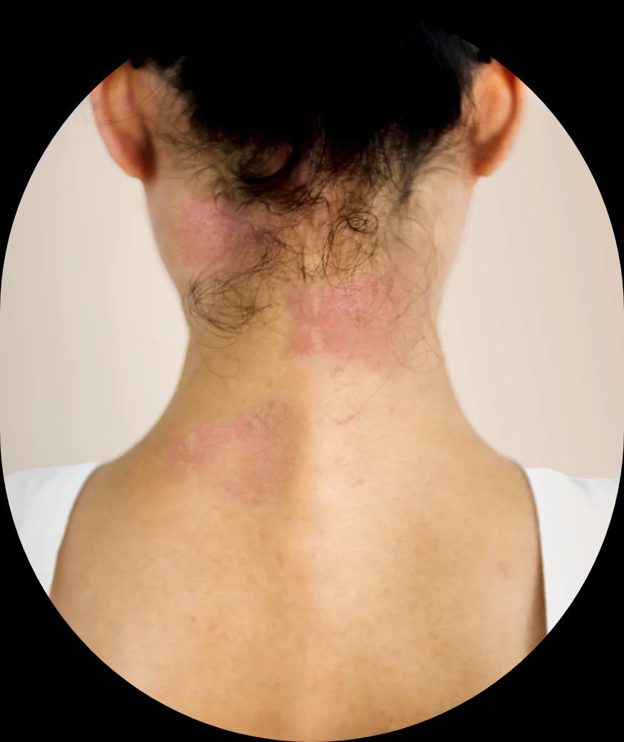 Skin Sercret