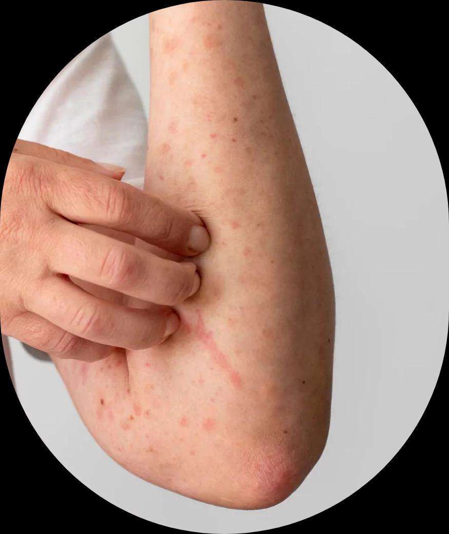 Skin Sercret